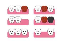 잇몸 염증 치료제 베스트 5