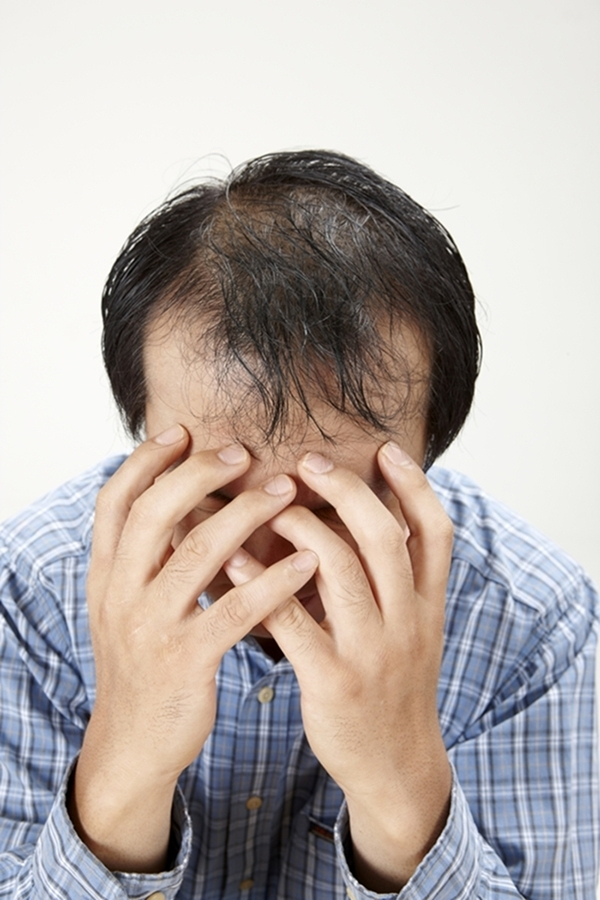 음주와 탈모의 연관성