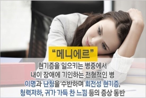 메니에르병이라고 하면 「젊은 여성이 스트레스로 현기증을 일으키는 병」이라고 하는 이미지가 있다고 합니다.