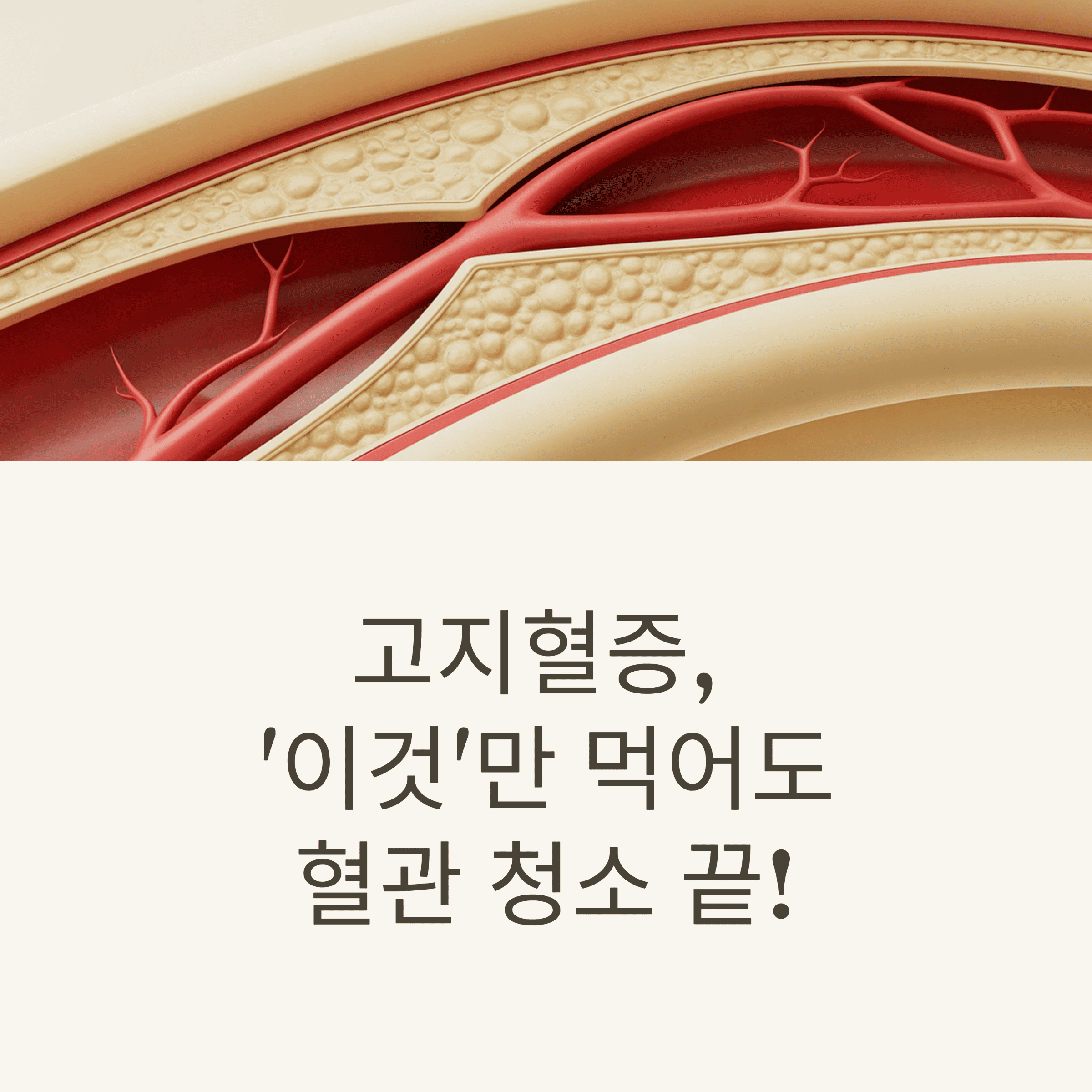 고지혈증 걱정 없이 건강한 일상 만들기