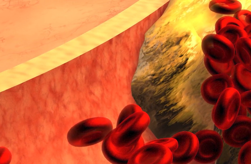 노니 효능 부작용