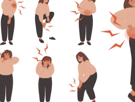 하지 정맥류 증상 수술비용