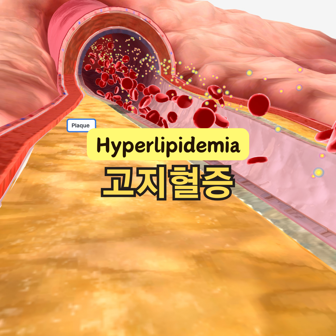 고지혈증 예방을 위한 생활습관, 건강한 혈액을 위한 필수 팁