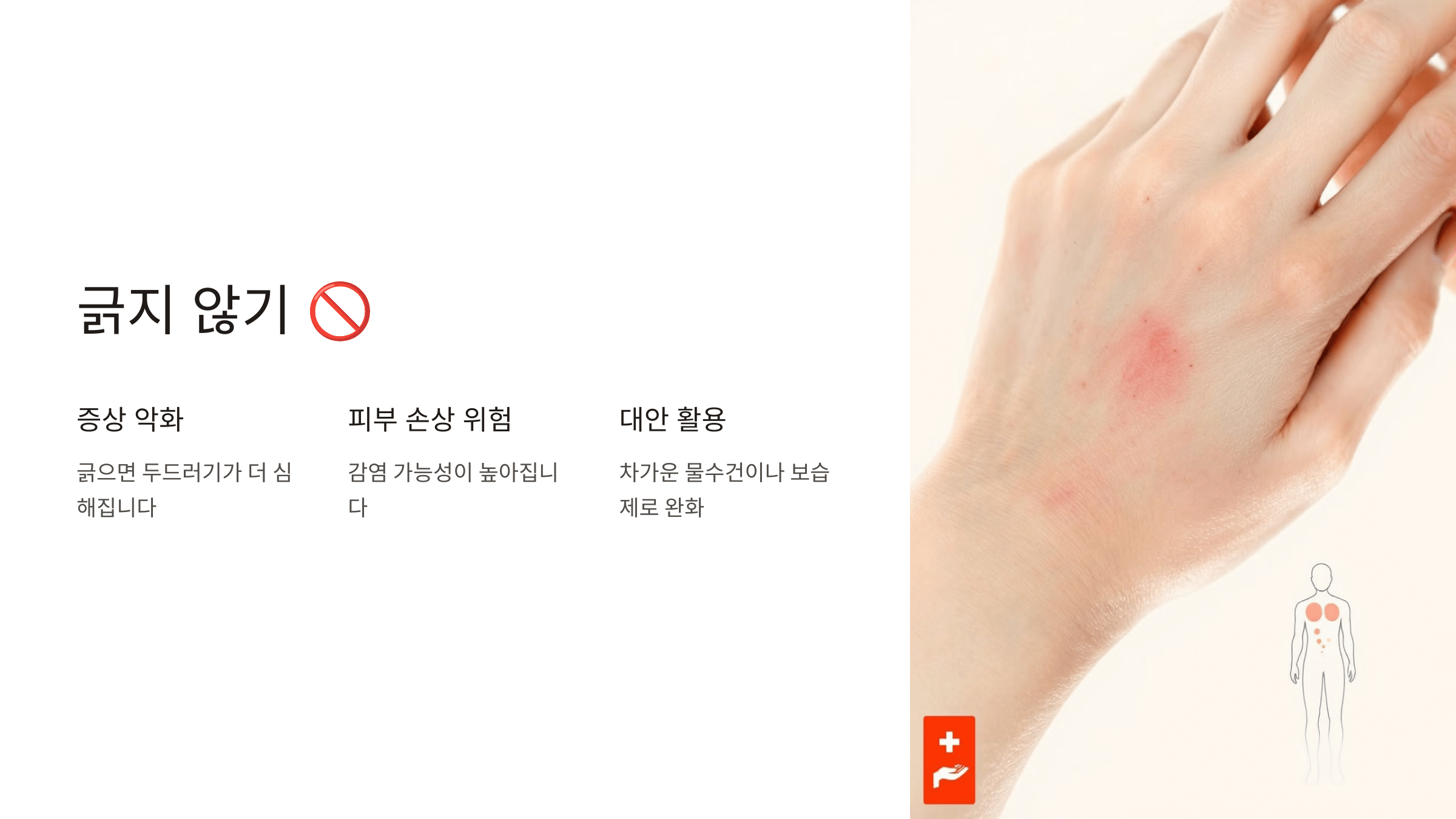 두드러기와 관련된 사진입니다.