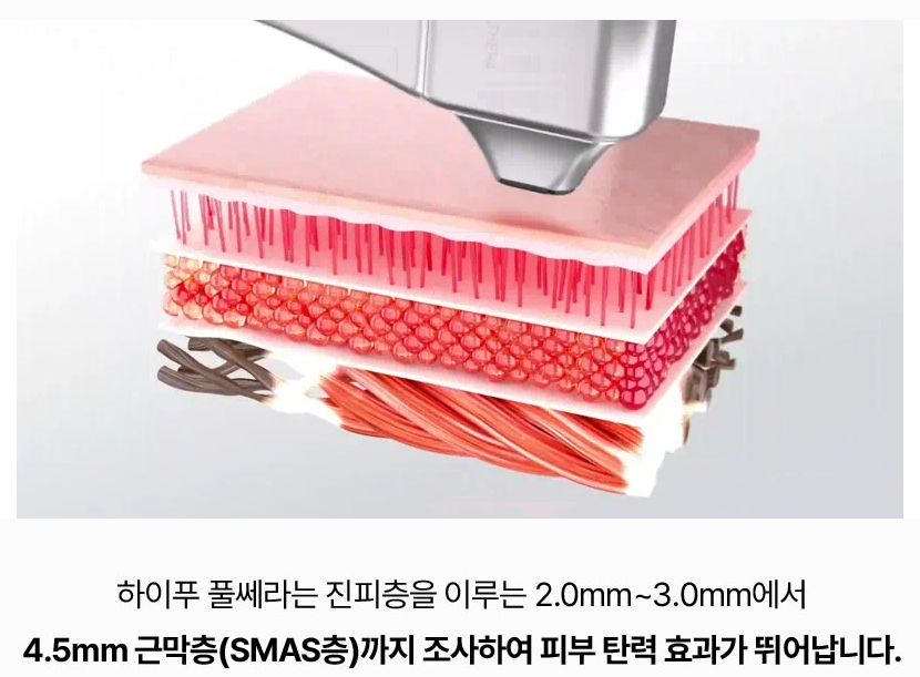 하이푸 풀쎄라