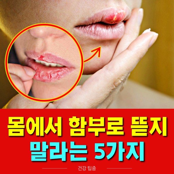 입술 각질 원인, 입술 건조증, 입술 갈라짐 ,건강 팁줌 매일꿀정보