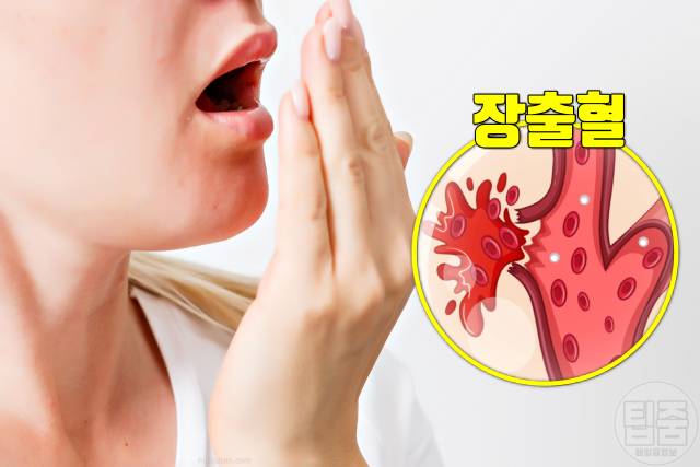 장 안좋을때 증상 입냄새 장 안좋으면 여드름 주사비
