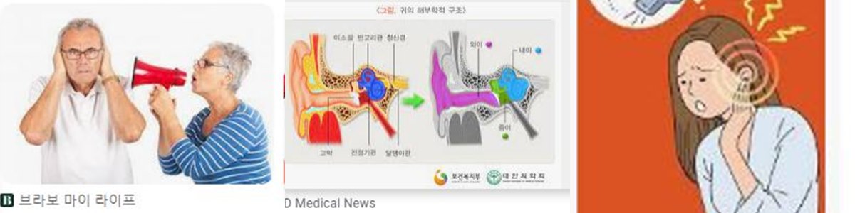 돌발성난청 -썸네일