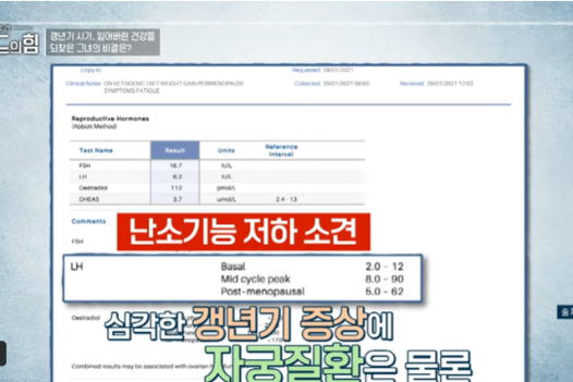 여성 갱년기 유산균 YT1