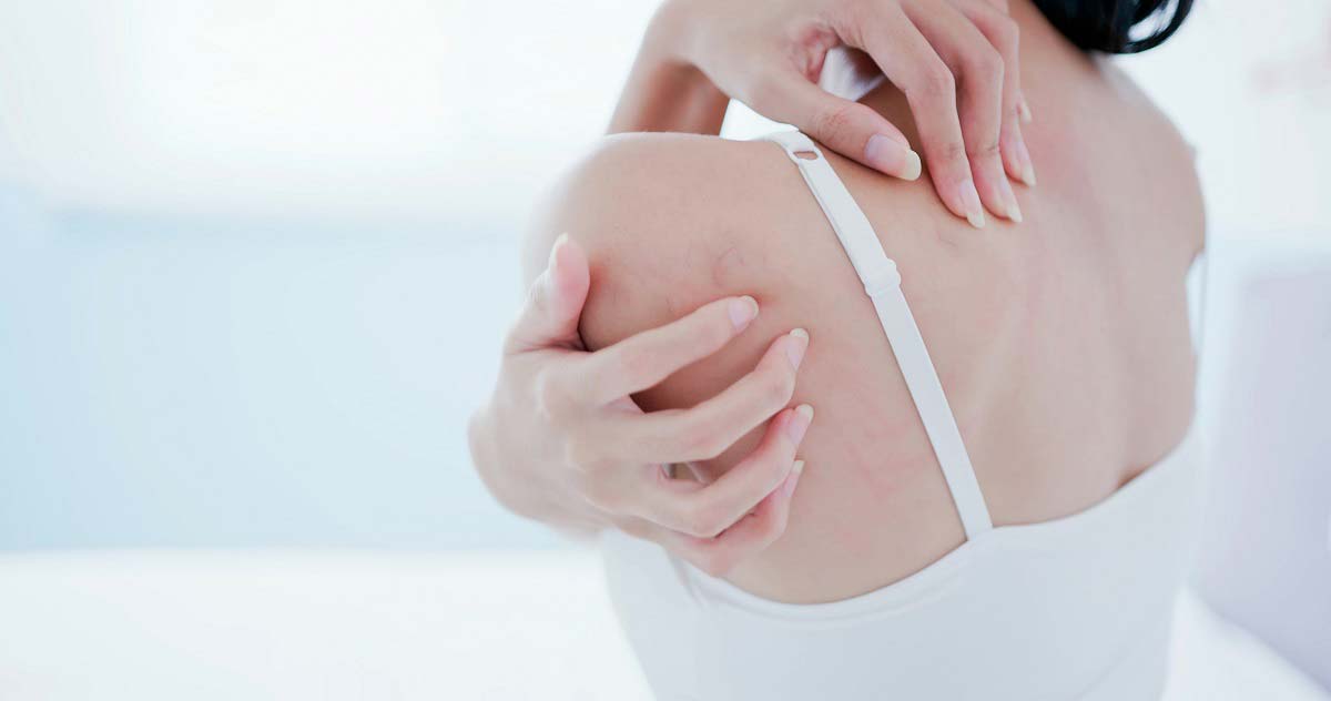 가드름 등드름 원인과 없애는 방법(시술X)