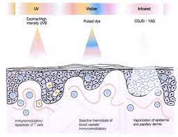 안티에이징스킨케어
