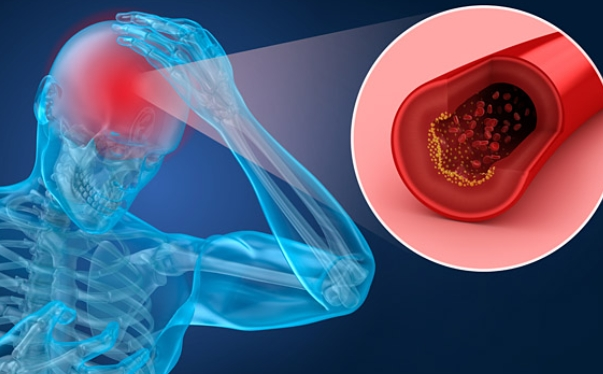 60๋ ํ์ก์ํ ๊ฐ์ , ์ง๊ธ ์์ํด์ผ ํ๋ ์ด์ ์ ์ค์ฒ๋ฒ