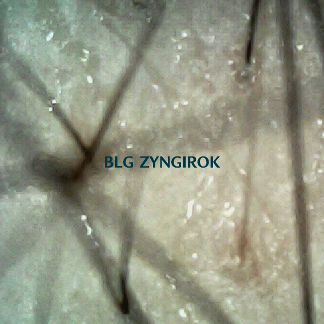 피나모아 29주차 - 정수리와 이마 사이 두피 모습이다.