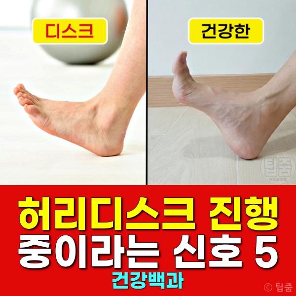 허리디스크 추간판탈출증 전조증상