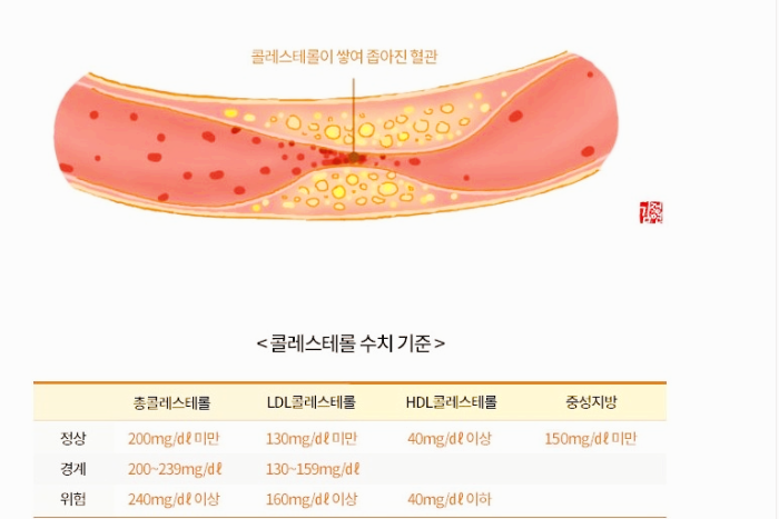 콜레스테롤 수치