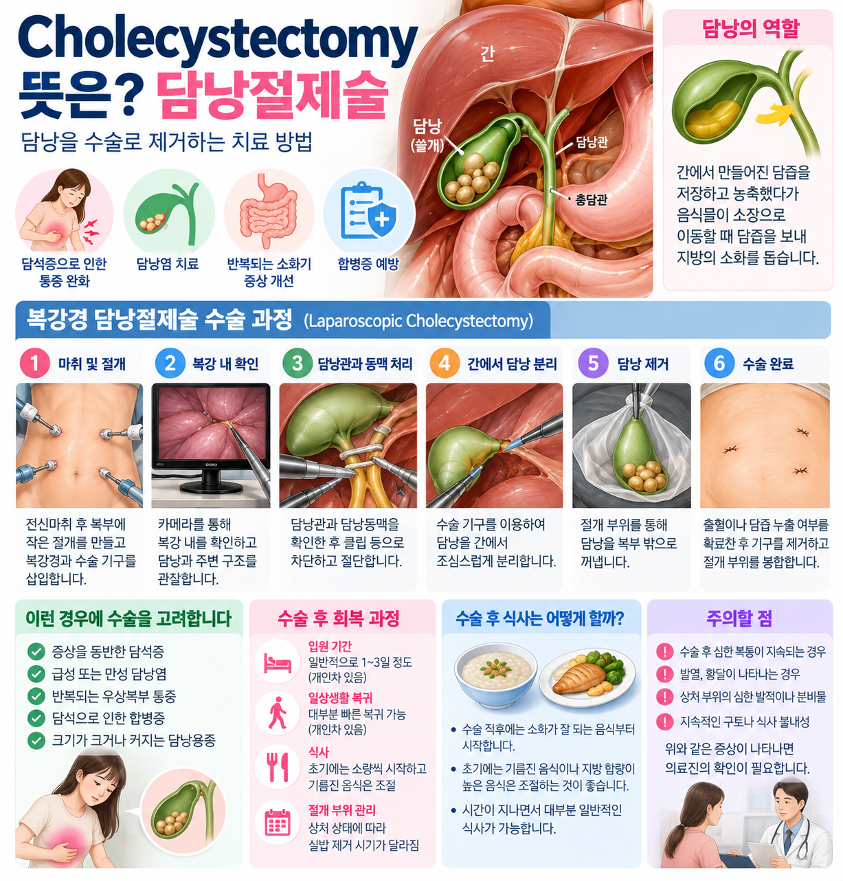 Cholecystectomy 뜻은? 복강경 담낭절제술 수술 과정과 회복