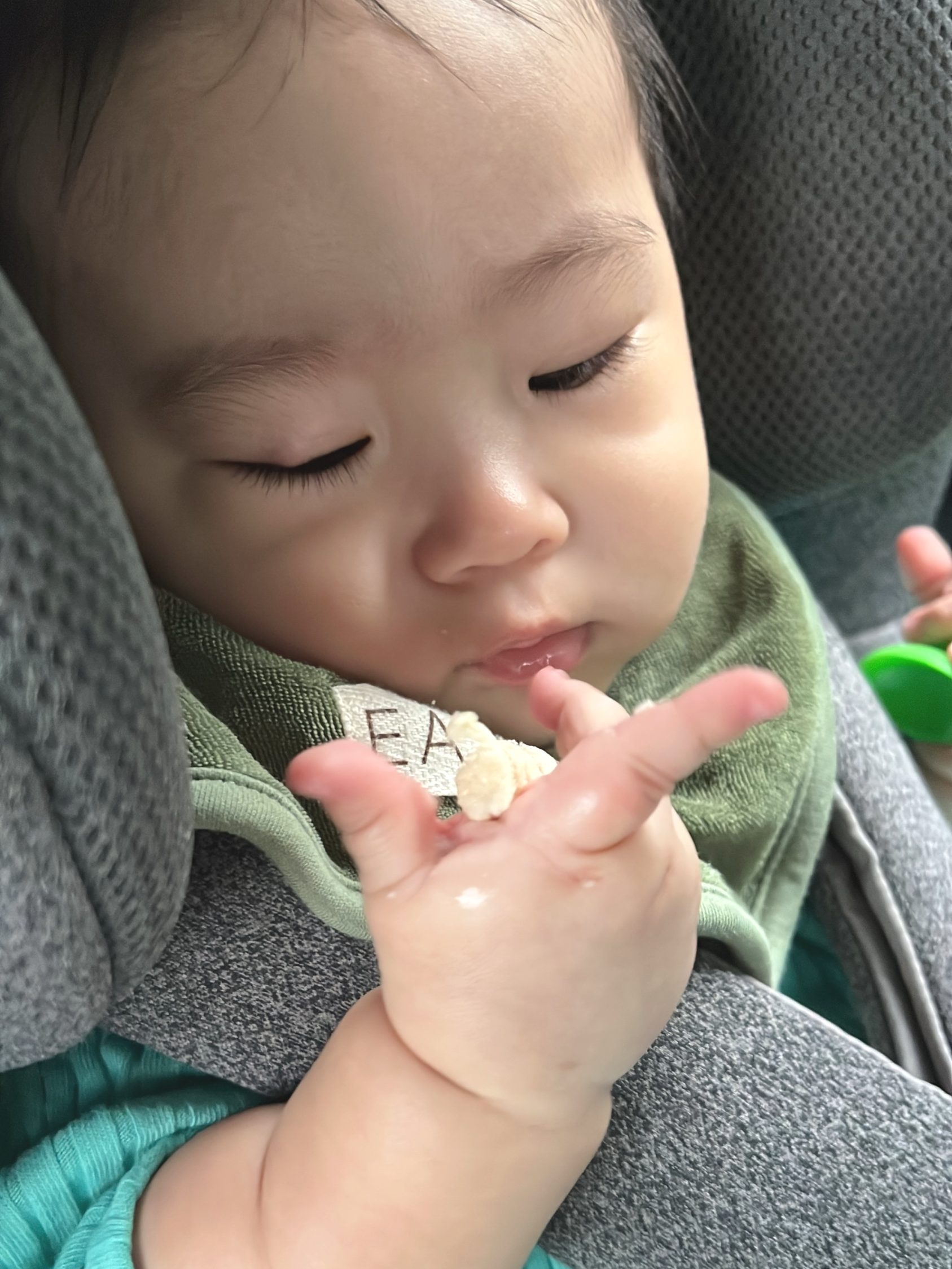 아기 다래끼가 점점 돌출된 모습 - 콩다래끼가 겉다래끼로 발전한 과정