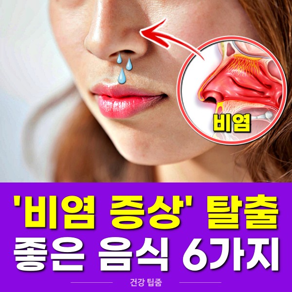 비염에 좋은 음식,비염 증상 탈출