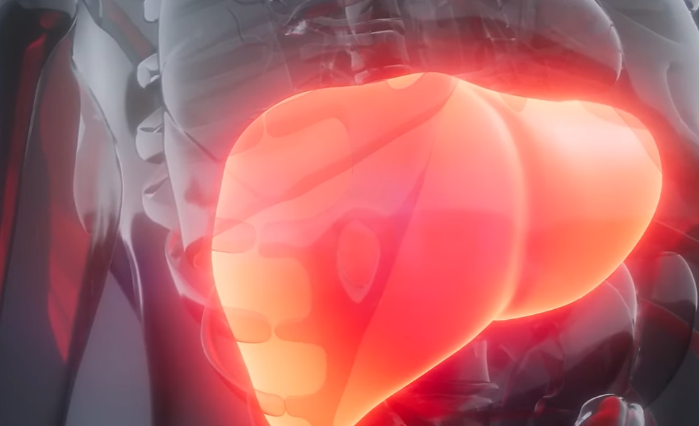 지방간 없애는 방법