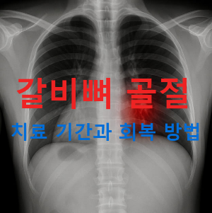 갈비뼈 골절 치료 기간과 회복 방법｜병원 진료가 꼭 필요한 증상은?