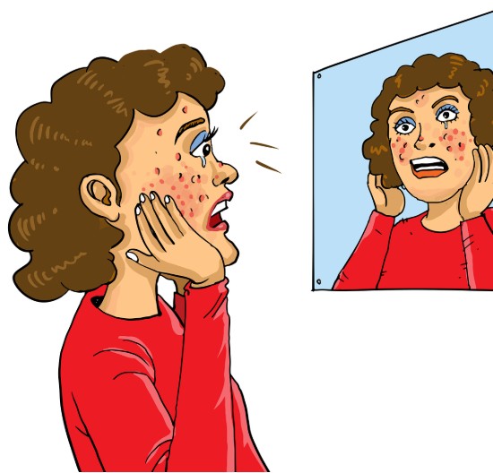 얼굴에-여드름이-많은-여성이-거울을-보며-깜짝-놀라고-있습니다.