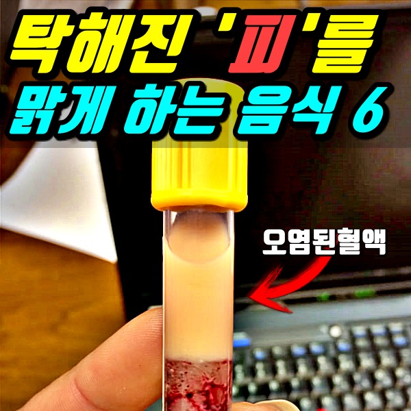 탁해진 피 고지혈증에 좋은 음식,팁줌