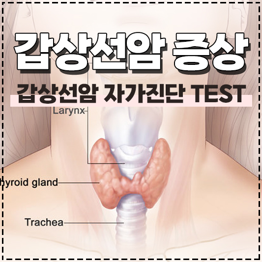 갑상선암 증상 자가진단 초기증상