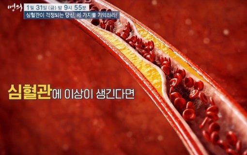 심혈관명의-김병극