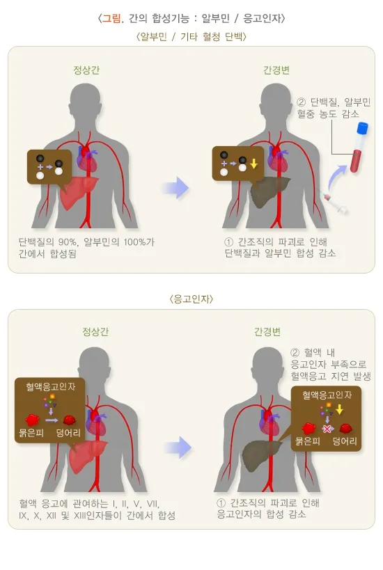 알부민 수치 알부민정상범위 알부민 많은 음식