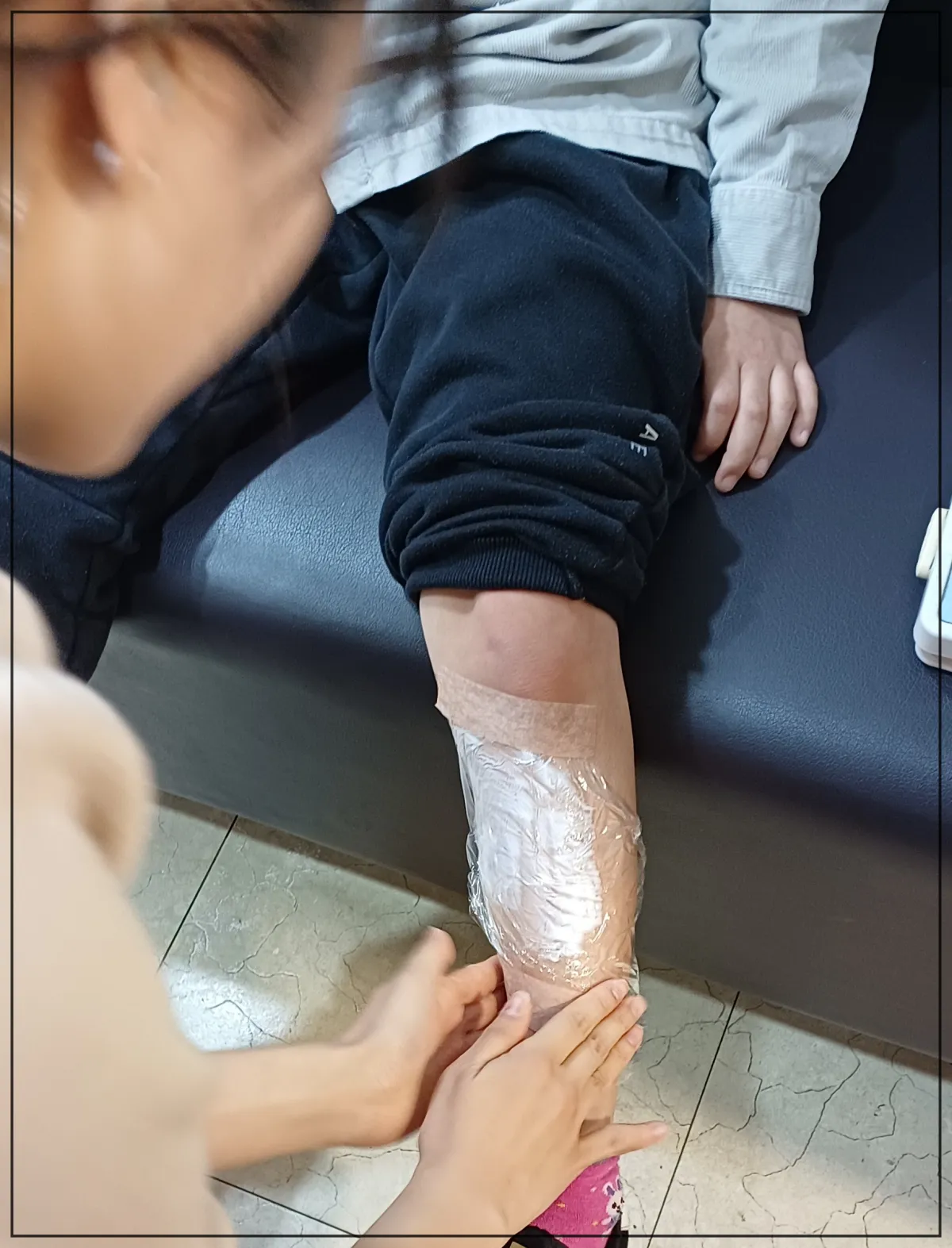 쇼파에-앉아있는-아이-하체쪽만-보임-왼쪽다리를-무릎위까지-걷었고-마취크림을-바른-모습-간호사로-보이는-여자어른이-처치해주고-있음