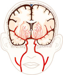 뇌경색 전조증상과 뇌졸중. 인간의 뇌는 우리 몸에서 가장 중요한 기관 중 하나입니다. 뇌를 통해 기억과 학습을 담당하고 신체 기관이 운동 기능을 수행할 수 있도록 하기 때문입니다. 뇌졸중과 뇌경색으로 심하게 손상되기 전까지는 일상생활에서 이상증상을 확인하기 어려우므로 평소에 주의를 하셔야 합니다.
