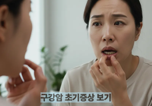 구강암 초기증상 보기