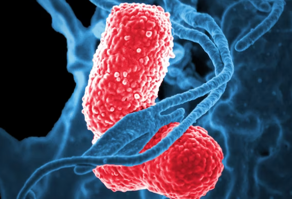 마이코플라즈마 폐렴