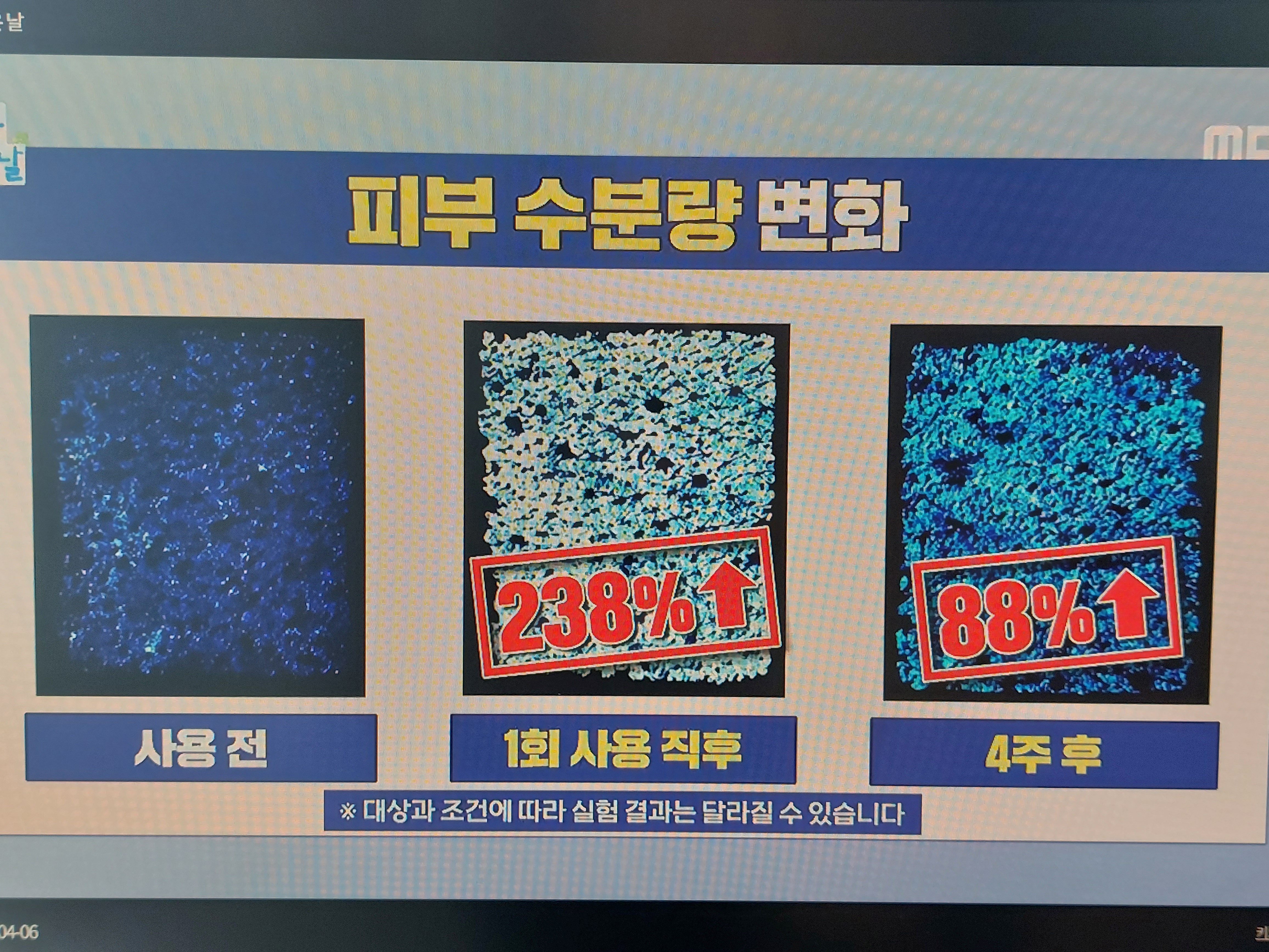 화이트 매스틱 효능