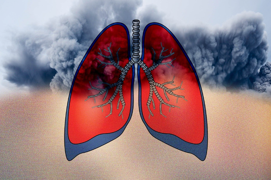 만성 폐쇄성 폐질환(COPD)이란? 주요 원인과 초기 증상까지 총정리!