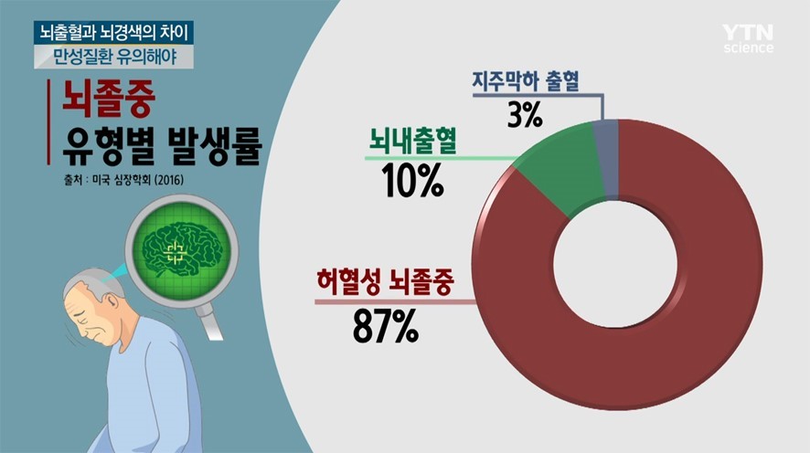 뇌졸중 전조증상과 체크리스트 및 예방과 치료