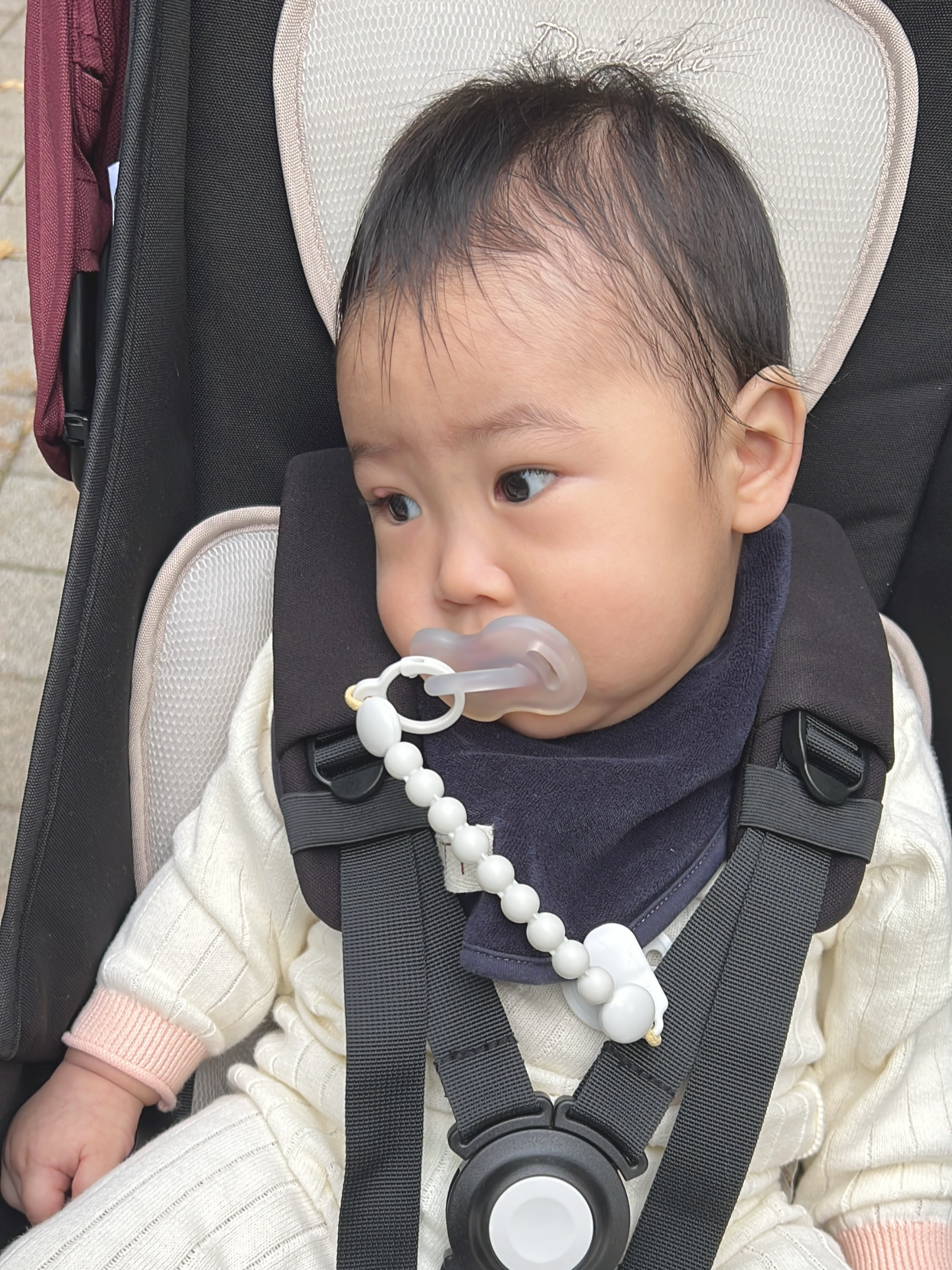 9개월 아기 겉다래끼가 부풀어 오른 모습 - 다래끼가 눈두덩 위로 돌출된 상태