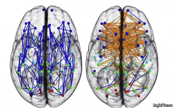 남녀의 뇌 연결망 구조