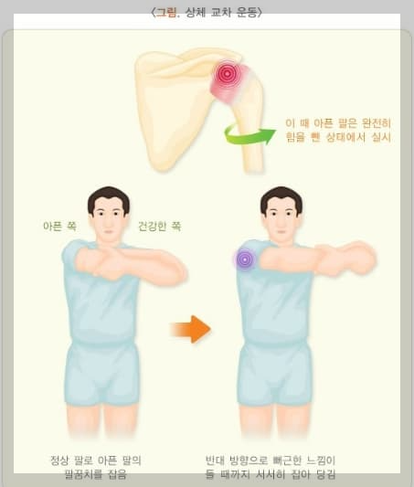오십견에-좋은-운동