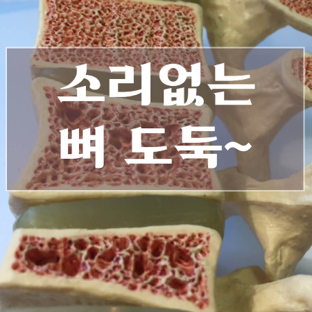 골다공증-수치