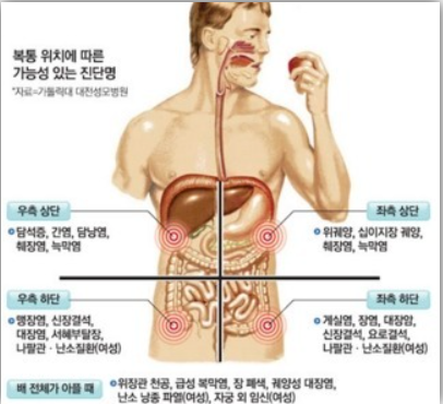 왼쪽 오른쪽 옆구리 통증 원인 5가지와 찌릿한 증상별 대처법 총정리