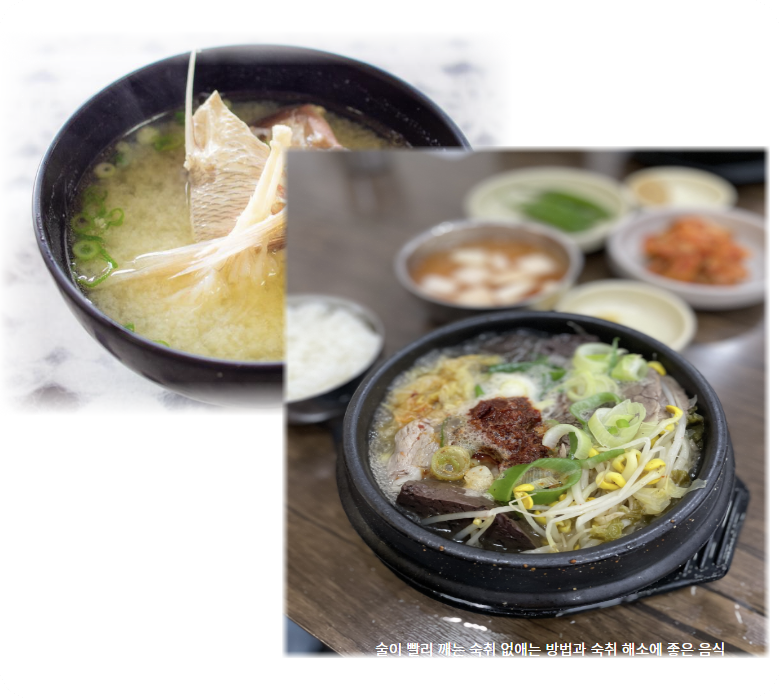 술이 빨리 깨는 숙취 해소 방법