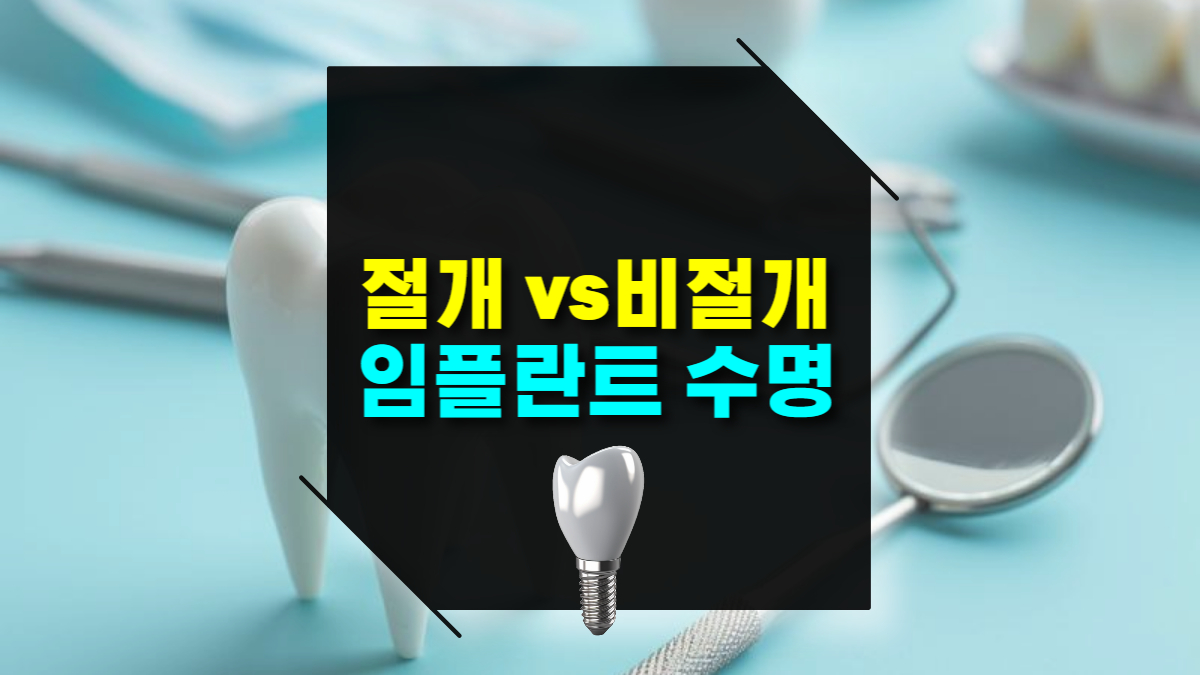 비절개 임플란트와 기존 임플란트 수명과 유지력 차이