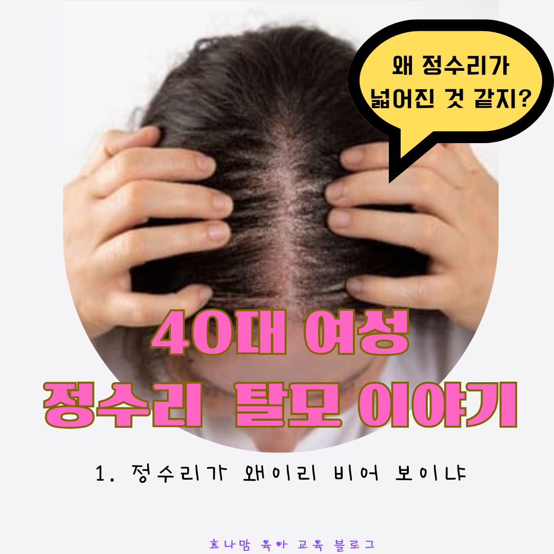 40대 여성 정수리 탈모