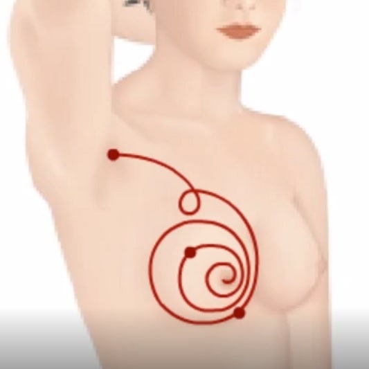 유방암 자가 진단