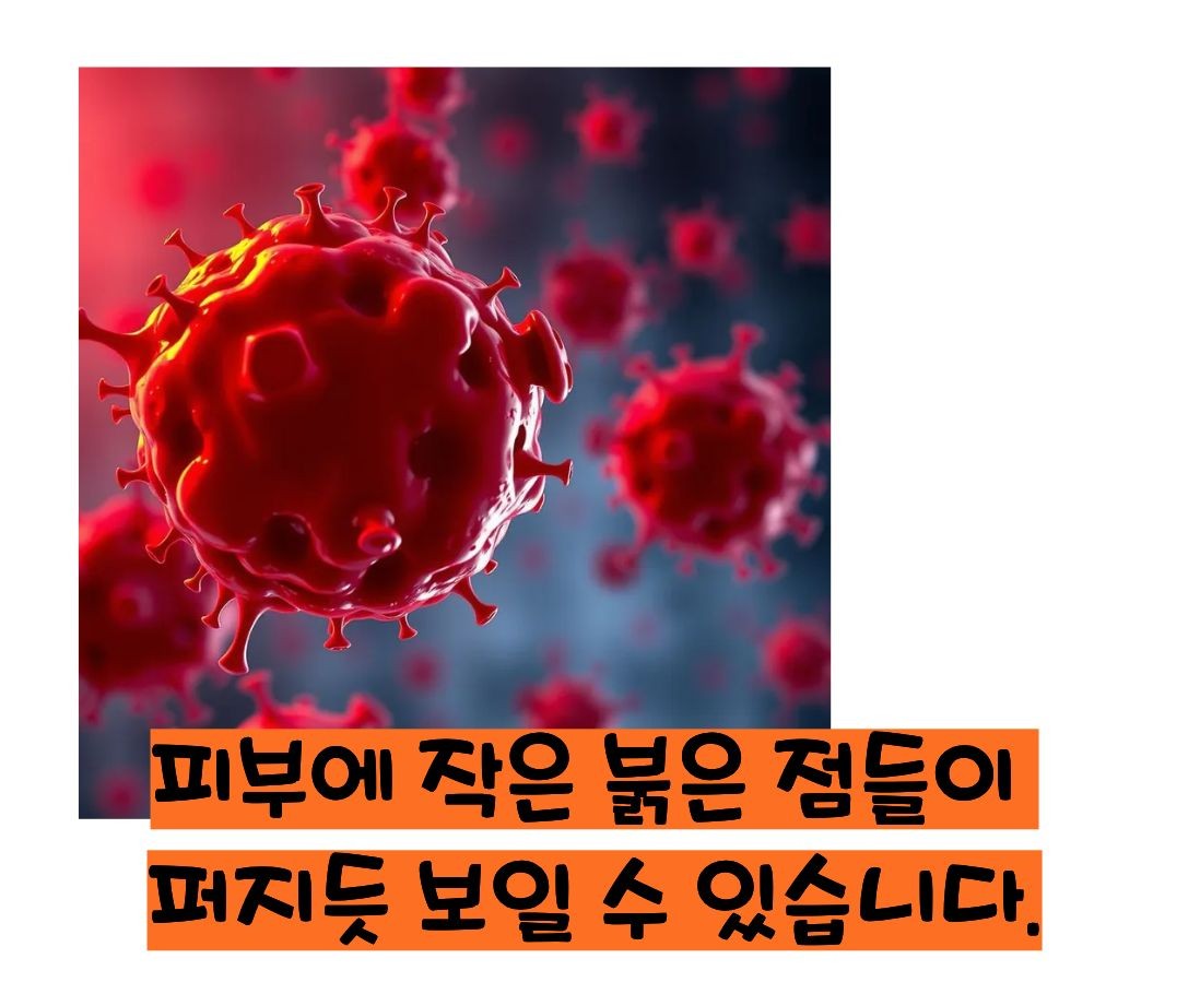 혈소판 감소증 증상