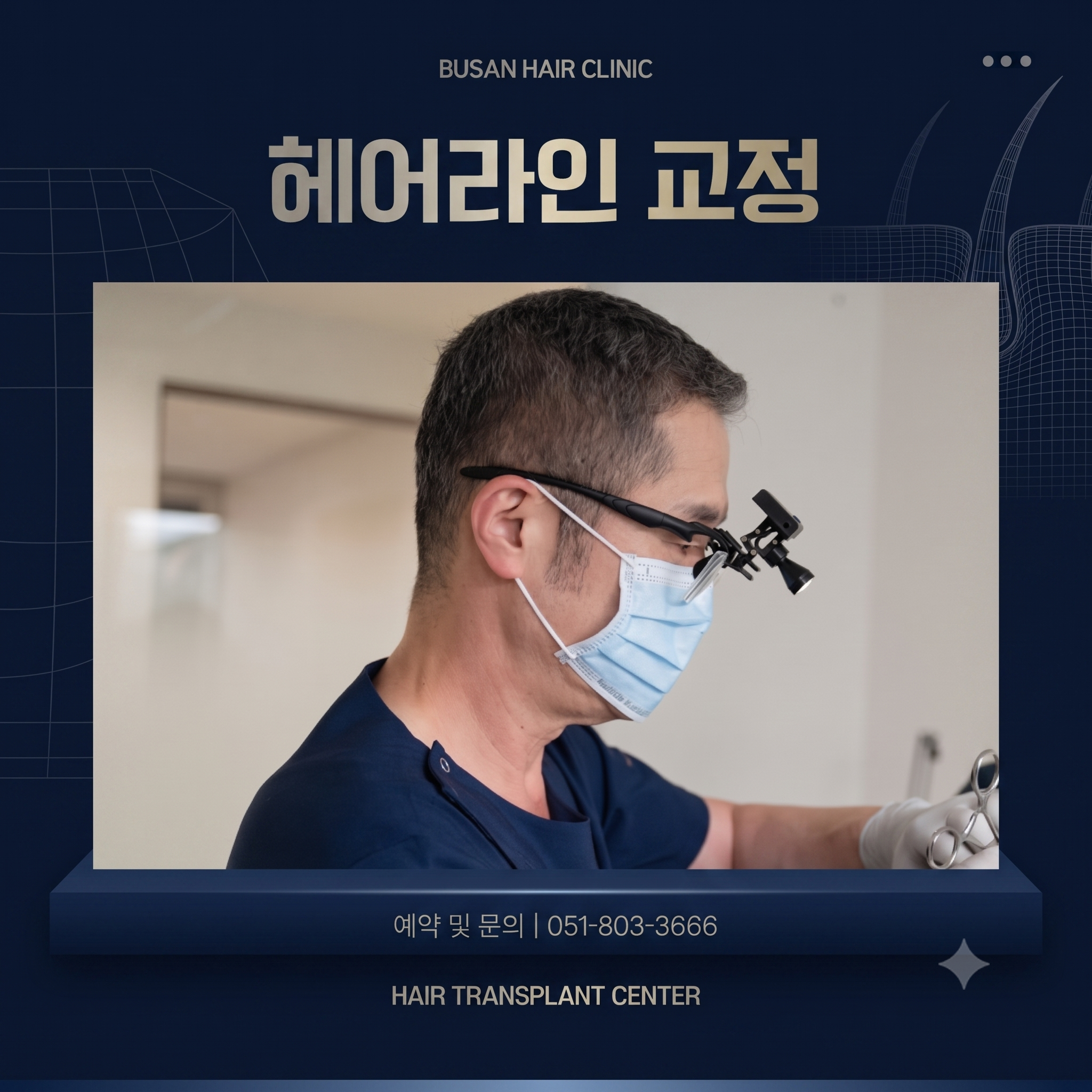 모발이식 시 헤어라인 교정 하는 모습을 AI로 구성