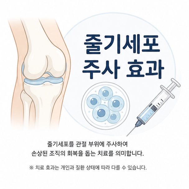 무릎 관절과 세포, 주사기 아이콘을 이용해 줄기세포 주사 효과를 살펴보는 주제를 소개하는 그림