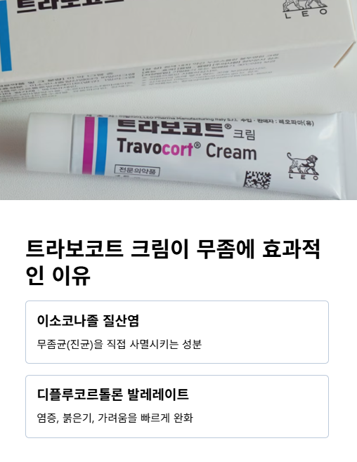 트라보코트 크림이 무좀에 효과적인 이유