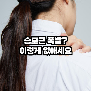 승모근 없애는 방법
